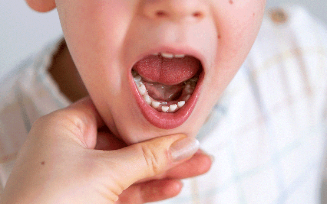 Mon enfant est-il couvert pour ses problèmes dentaires ?